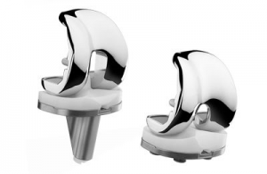 Proth&egrave;se Totale de Genou