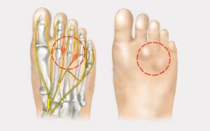 ChirurgieOrthop&eacute;dique.Com - Dr Benjamin Guenoun - Paris